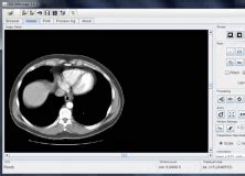 Tudor DICOM Viewer 1.8 Download (Free)